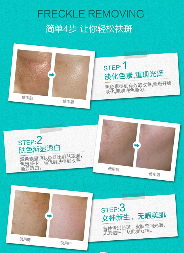 时尚节目美丽俏佳人力荐lilia晶彩靓妍美白祛斑霜美白嫩肤淡化色斑50g